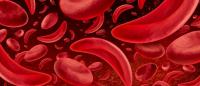 Regular cells mixed with sickle cells